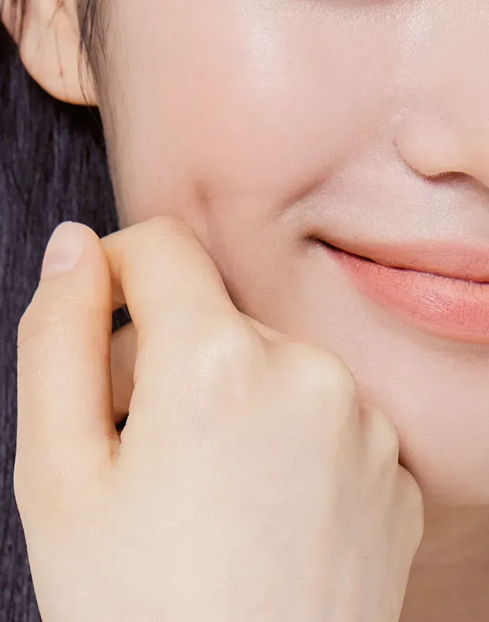 여드름 흉터 치료, 회복새살침 – 오래된 여드름 흉터, 왜 치료가 어려웠을까요?