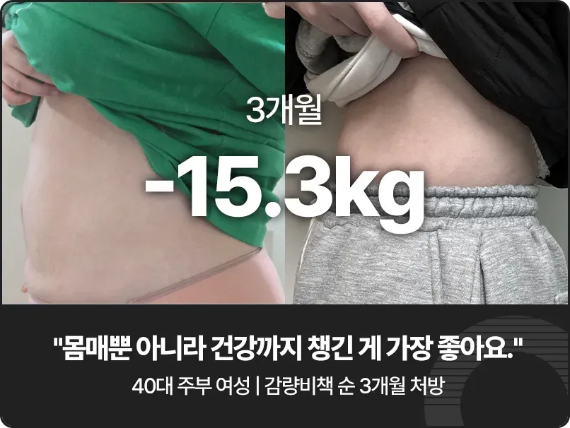 강남 다이어트 한의원, 형인재 감량비책 치료 후