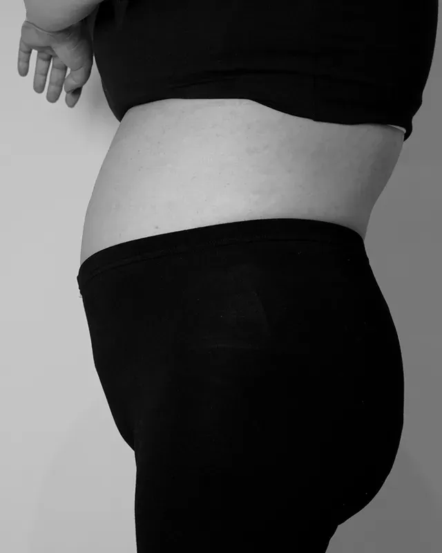 다이어트 한약, 형인재 감량비책 치료 전