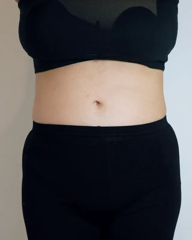 다이어트 한약, 형인재 감량비책 치료 후