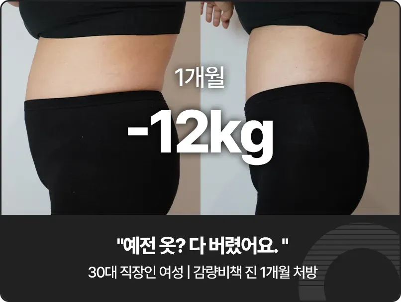 강남 다이어트 한의원, 형인재 감량비책 치료 전