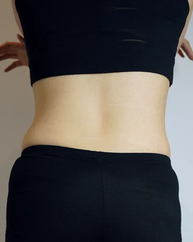 다이어트 한약, 형인재 감량비책 치료 후