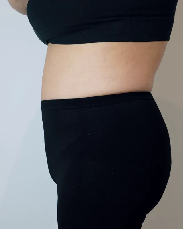 다이어트 한약, 형인재 감량비책 치료 후